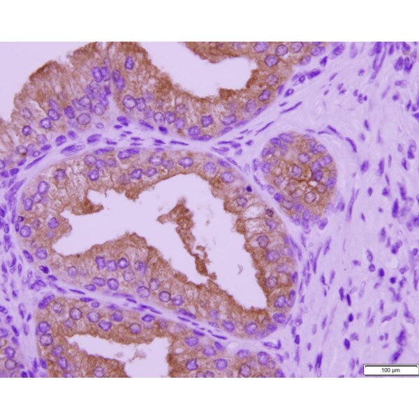 Control Slide, IHC, PSA